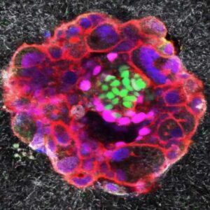 kisirlik derdine umut oldu embriyosunun rahme yerlesme ani ilk kez goruntulendi WAuFQAms